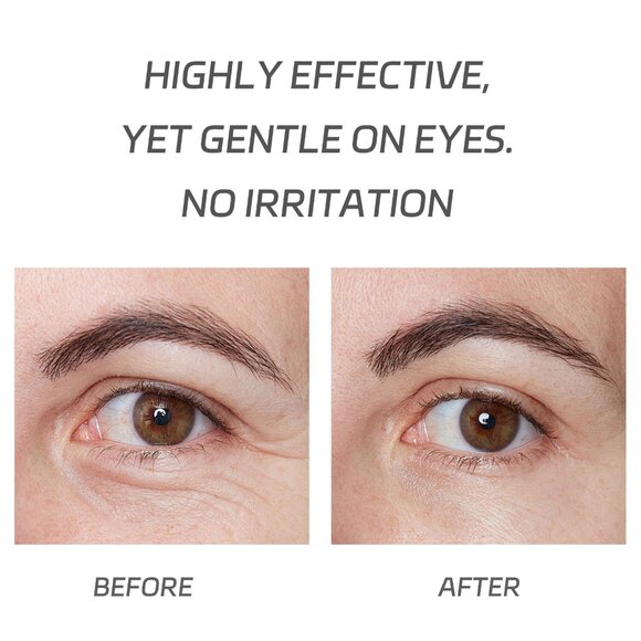 VGO Eye Cream, Eye Repair Cream Under Eye Cream for Dark Circles & Puffiness, Mo - Picture 6 of 11
